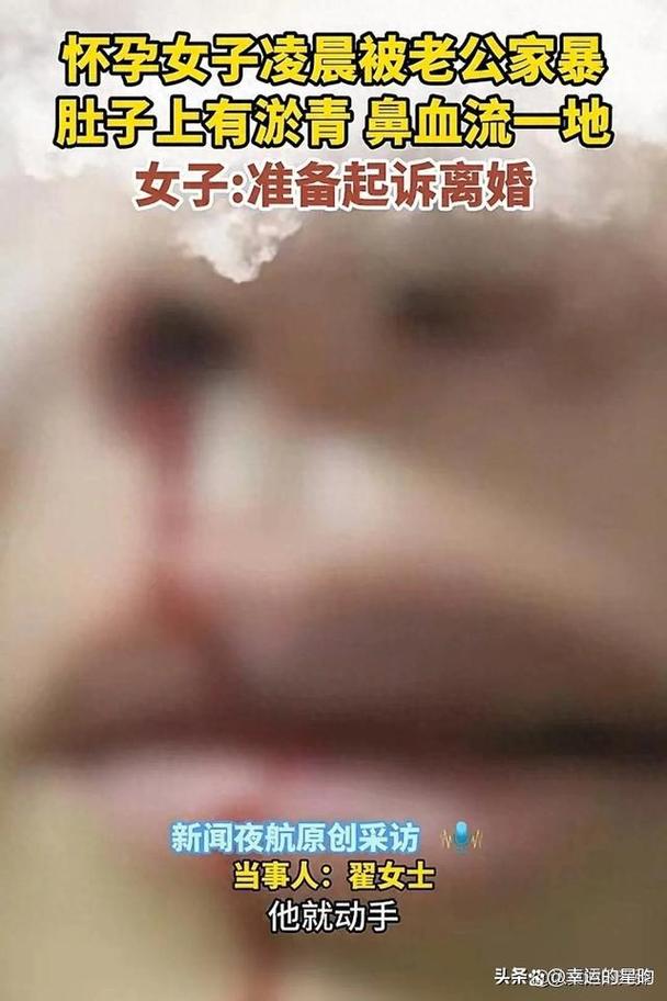 老公打孕妇,法律如何惩处?